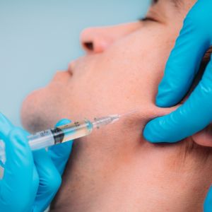 Jawline Injection/Consultation - Priscilla Reeser, PA-C
