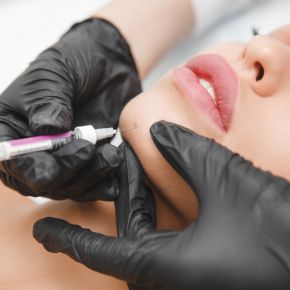Chin Filler Injection/Consultation - Priscilla Reeser, PA-C