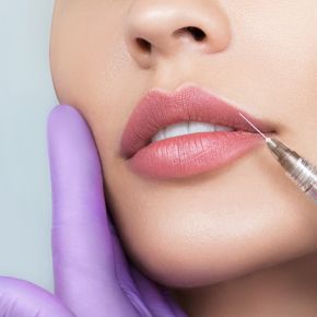 Lip filler Injection/Consultation - Priscilla Reeser, PA-C