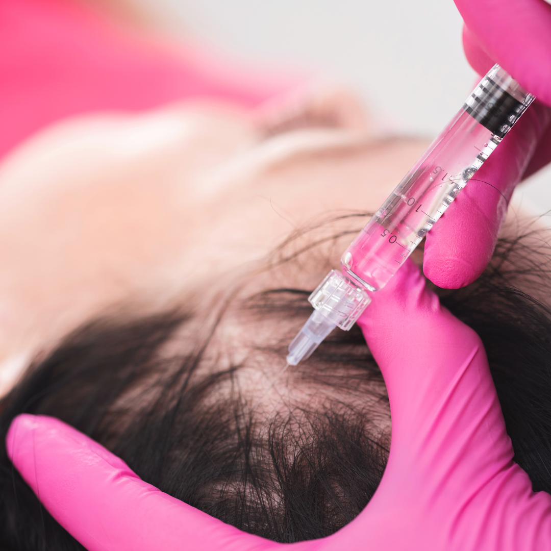 Hair loss injection Therapy - PRP individual
